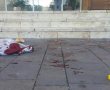 ירי באשקלון: צעיר נפצע באורח קשה